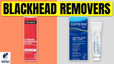 Best Blackhead Removers